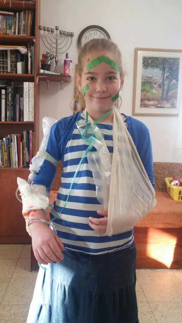 אפרת "הפצועה"