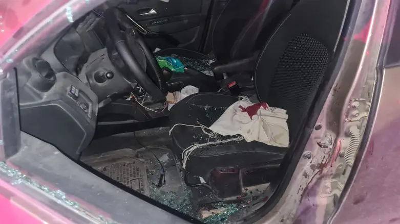 'I thought I got a bullet in my head'