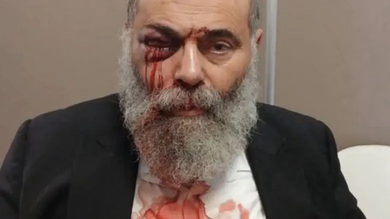 Jewish man assaulted in France over Shabbat