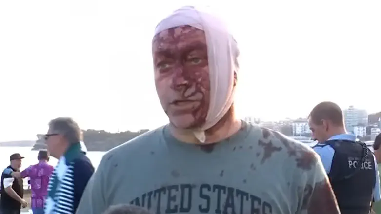 הפיגוע בסידני | פצוע הטבח: „ראיתי דבר כזה רק ב־7.10”