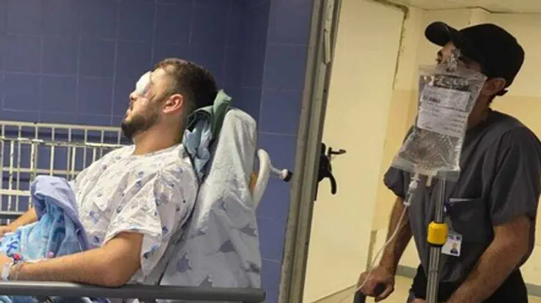 צילום: באדיבות המצולם Israeli assaulted in Cyprus: 'They stabbed me in the eye'