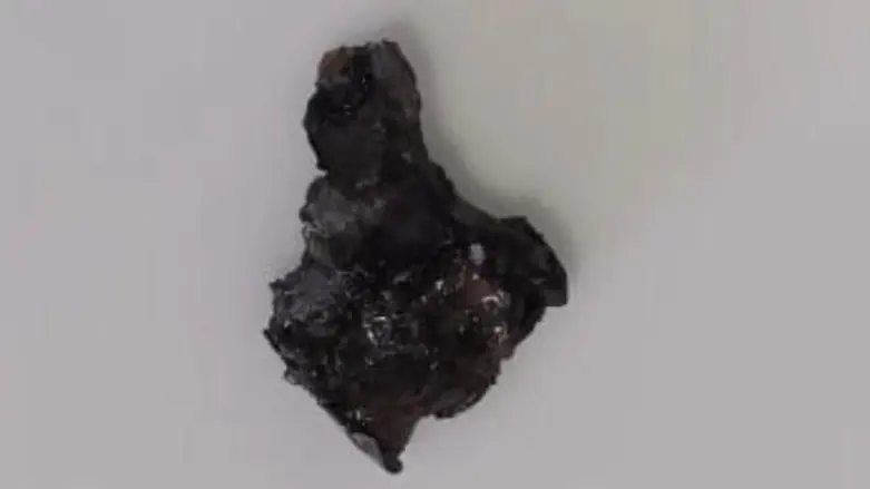 Smotrich shows the piece of shrapnel that wounded his son