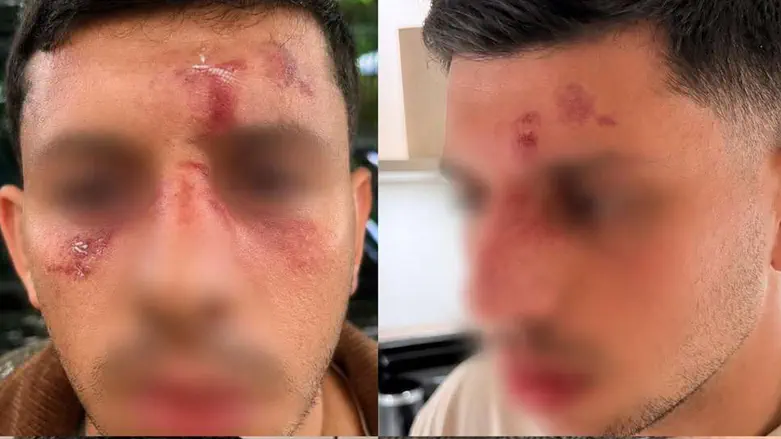 no credit Young man spoke Hebrew and was attacked by masked men