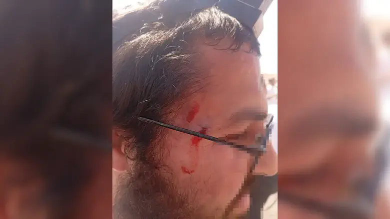 Jewish hikers attacked after mistakenly entering Arab village
