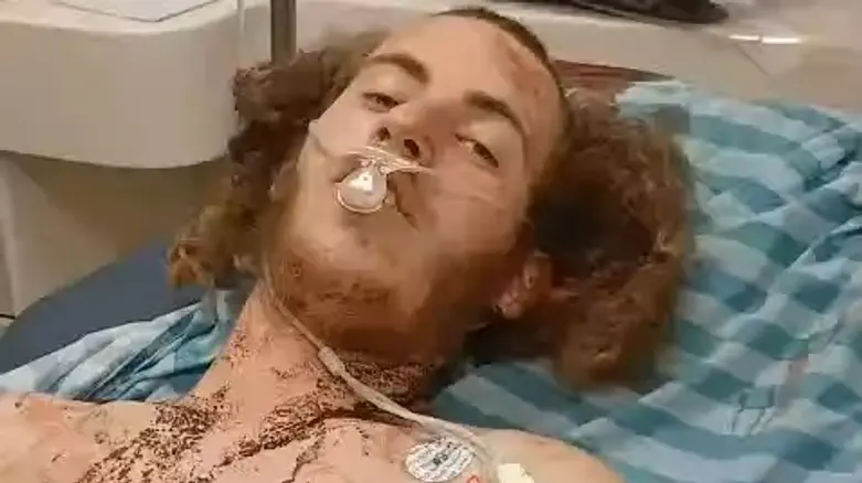 no credit “I fought the terrorist - Then I saw I was covered in blood"