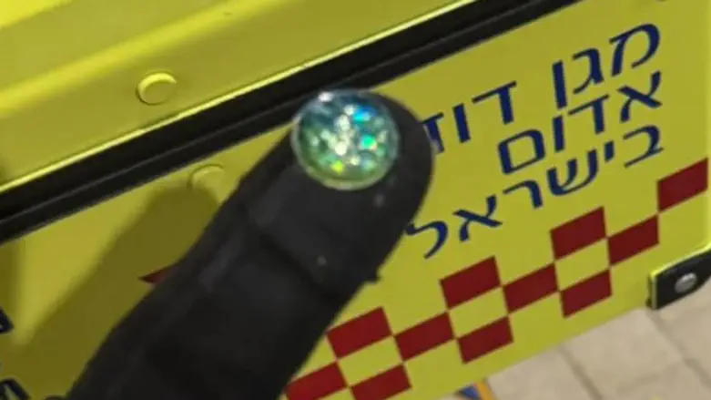התינוק הכחיל – החובש שלף את קישוט הסוכה
