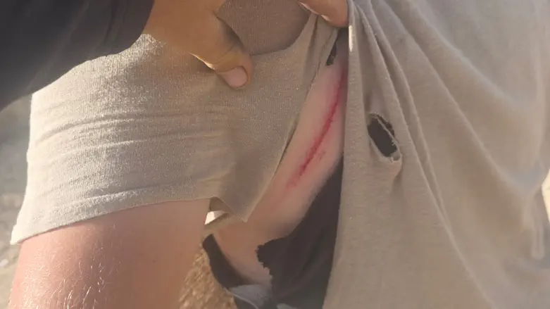 Hikers attacked in Samaria