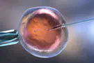 Health Ministry warns: Cancer risk from sperm donor mutation