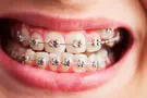 צילום: FREEPIK חיוך מושלם בדרך חדשנית