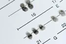 צילום: Shutterstock רשלנות רפואית בהריון - ספינה ביפידה