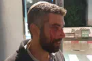 צילום: הרב עזרא היימן "אללה אכבר": הרב נתנאל אביטן הותקף ביפו