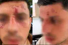 Young man spoke Hebrew and was attacked by masked men