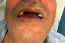 Koach LaOvdim 'I was beaten and lost consciousness'