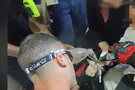 Child's hand gets caught in a mixer beater