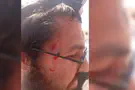 Courtesy of the photographer Jewish hikers attacked after mistakenly entering Arab village