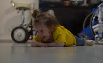 Noa and Uriel were born with a disability