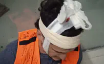 פצועי הלינץ' ברעננה עדיין במעצר בית