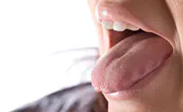 ללקק את הטלוויזיה        