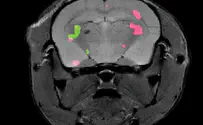 מבעד לרקמות: החיים החדשים של סריקות ה-MRI