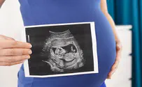Researchers find anomalies in 30% of fetuses who develop autism
