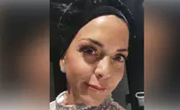 "יש לי כדור בראש. אני חיה את זה כל יום"