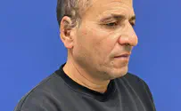 Man's ear reattached in groundbreaking surgery