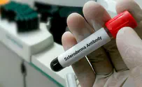 Getting under the skin of an autoimmune disorder