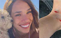 Arabs assault former beauty queen out walking her dog