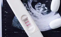 Haredim only sector in Israel not backing a 'right to abortion'