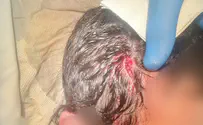 Arab who stabbed Jew released within less than a week