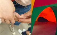 Toddler bitten by rat in Bnei Brak daycare