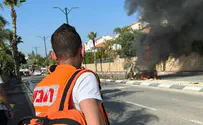 ראשל"צ: גבר נכווה בשריפת רכב, מצבו קשה