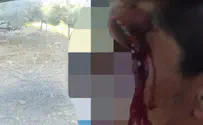 Two Israeli farms attacked within minutes