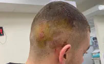 גונן על אחותו והותקף בידי עשרות ערבים