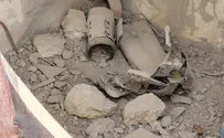 Трое пострадавших в результате обстрела Севера