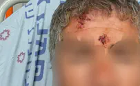 Violent clashes near Israeli farm leave two injured
