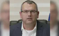 פיקוח נפש דוחה קשקשת, קצת פרופורציות