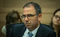 לא רואה את הגיבנת