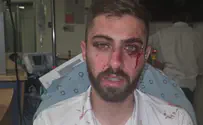 נהג אוטובוס הותקף באלימות בירושלים