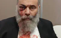 يهودي يبلغ من العمر 67 عاماً يُهاجم في فرنسا