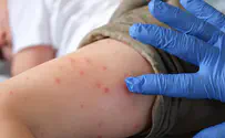 Petah Tikva joins list of measles outbreak hotspots