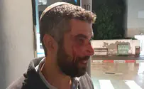 צילום: הרב עזרא היימן "אללה אכבר": הרב נתנאל אביטן הותקף ביפו