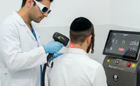 הסרת שיער בלייזר בעידן החדש