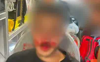 Тяжело пострадал молодой болельщик. Трое арестованных