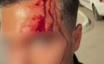 צילום: דוברות המשטרה תקף שוטר, פצע אותו בראשו - ונעצר