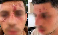 no credit Young man spoke Hebrew and was attacked by masked men