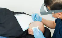 צילום: istock What Actually Determines Whether a Hair Transplant Succeeds