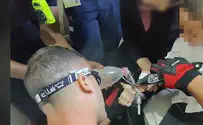 צילום: כבאות והצלה ידו של ילד נלכדה במקצף של מיקסר - לוחמי האש חילצו אותו ללא פגע