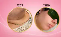 הטכנולוגיה שמאפשרת להציע התחייבות לתוצאות