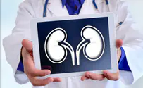 iStock Sometimes a perfect body has only one kidney